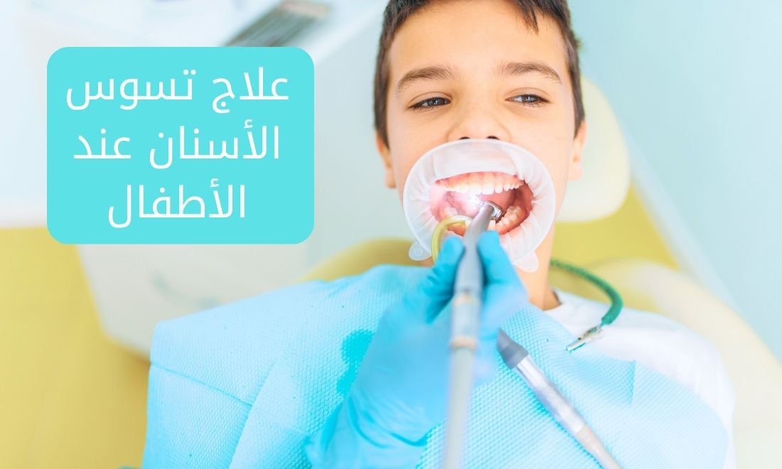 علاج تسوس الأسنان عند الأطفال