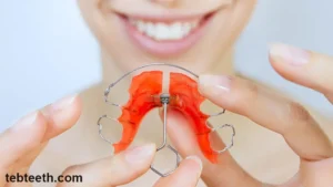 Removable Orthodontic Braces – Advantages, Disadvantages, Prices, and More