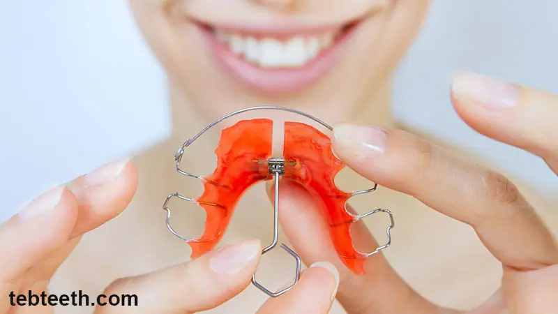 Removable Orthodontic Braces – Advantages, Disadvantages, Prices, and More