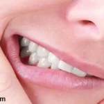 علاج خراج اللثة بالمنزل