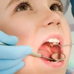 دواء لتسكين ألم الأسنان فورًا للاطفال