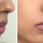 سواد حول الفم