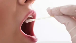 كثرة اللعاب في الفم