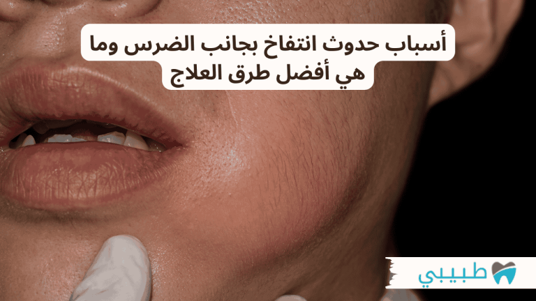 أسباب حدوث انتفاخ بجانب الضرس