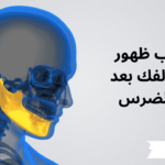 أسباب ظهور عظم الفك بعد خلع الضرس
