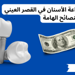 أسعار زراعة الأسنان في القصر