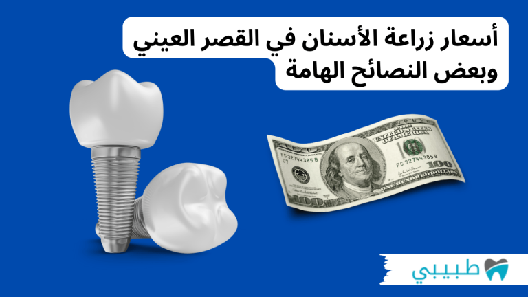 أسعار زراعة الأسنان في القصر