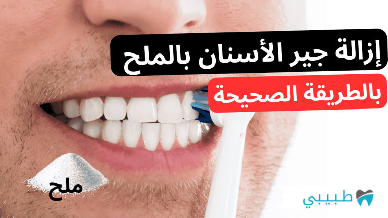 إزالة جير الأسنان بالملح
