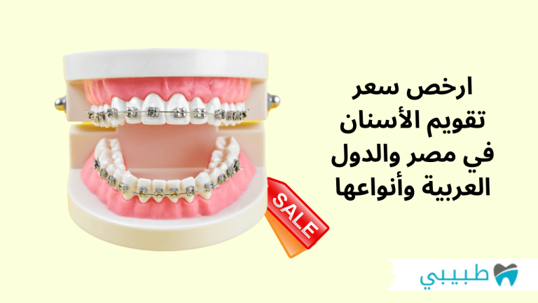 ارخص سعر تقويم الأسنان في مصر