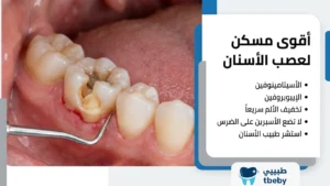 اقوى مسكن لالام عصب الأسنان