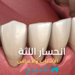 الأسباب والأعراض