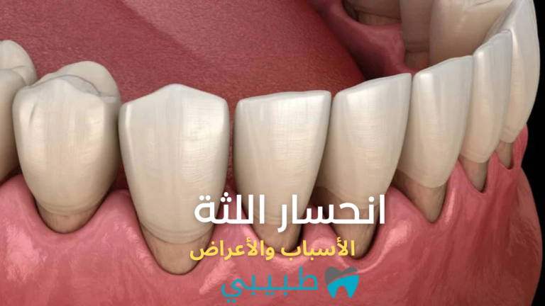 الأسباب والأعراض