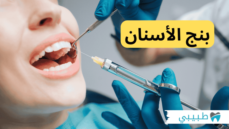 بنج الاسنان