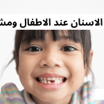 تبديل الاسنان عند الاطفال ومشاكلها
