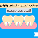 تصبغات الاسنان