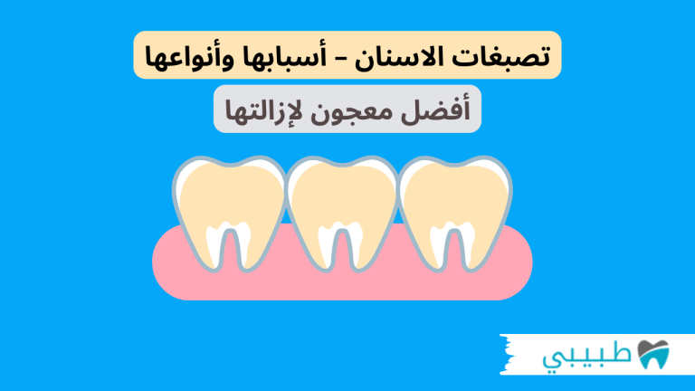 تصبغات الاسنان