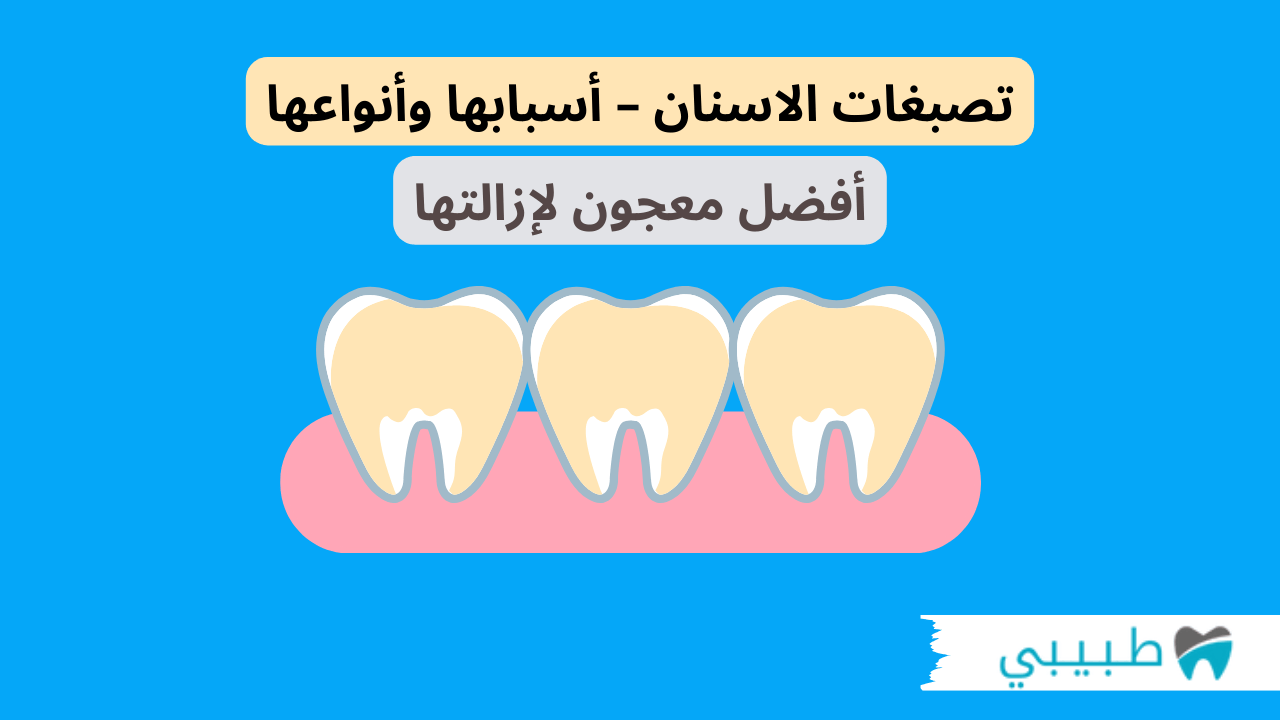 تصبغات الاسنان