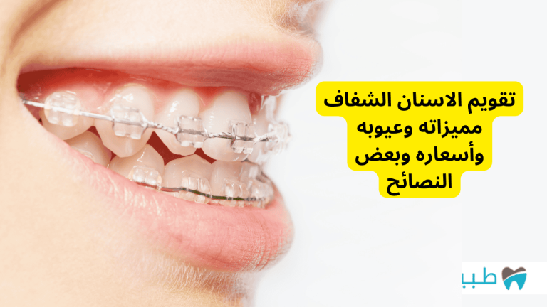 تقويم الاسنان الشفاف