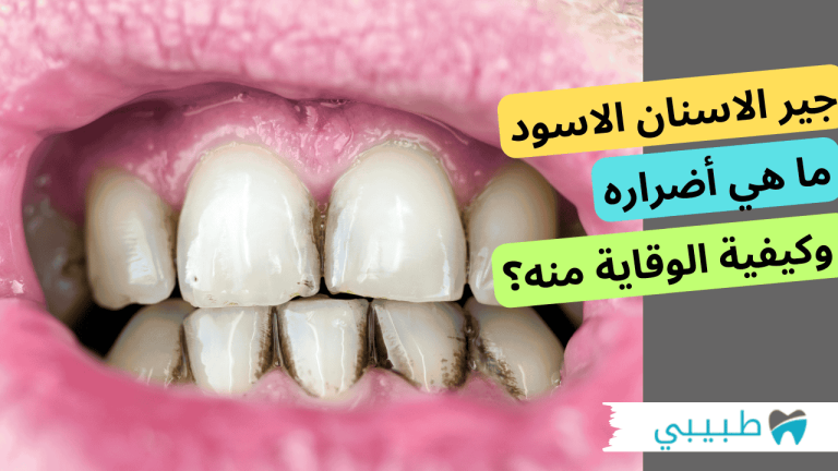 جير الاسنان الاسود
