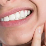 رابيدوس للاسنان