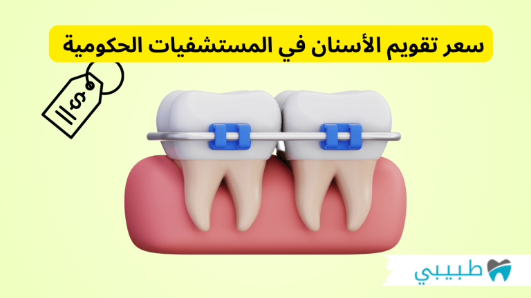 سعر تقويم الأسنان في المستشفيات الحكومية