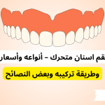طقم اسنان متحرك