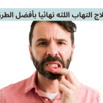 علاج التهاب اللثه نهائيا بأفضل الطرق