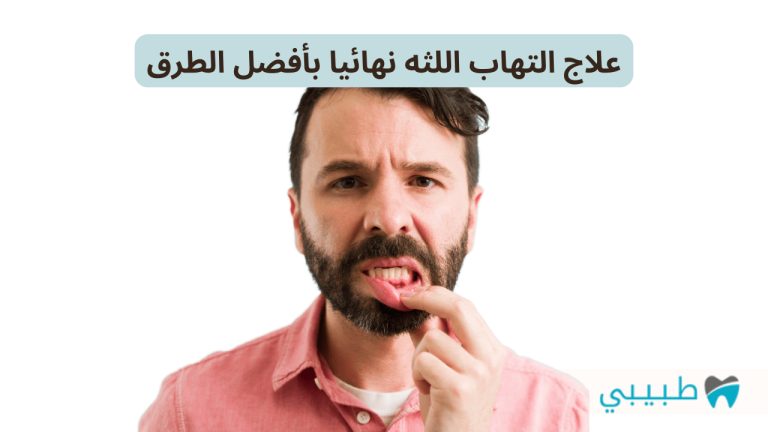 علاج التهاب اللثه نهائيا بأفضل الطرق