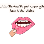 علاج حبوب الفم بالأدوية والأعشاب