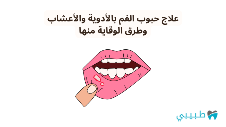 علاج حبوب الفم بالأدوية والأعشاب