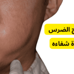 علاج خراج الضرس بالطرق المنزلية أو الطبية