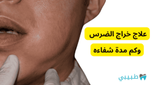 علاج خراج الضرس بالطرق المنزلية أو الطبية
