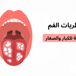 علاج فطريات الفم من الصيدلية للكبار وللأطفال