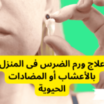 علاج ورم الضرس فى المنزل بالأعشاب أو المضادات الحيوية