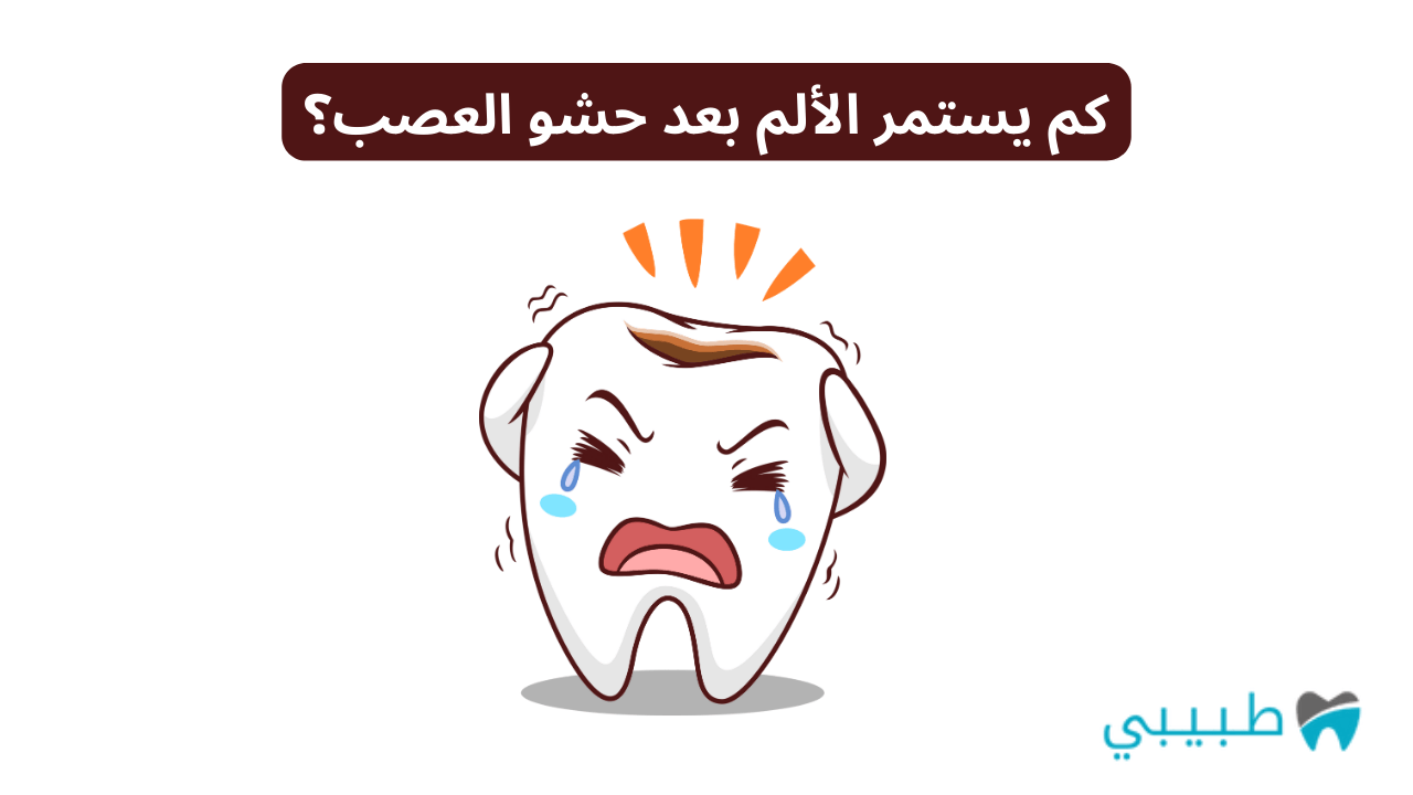 كم يستمر الألم بعد حشو العصب؟