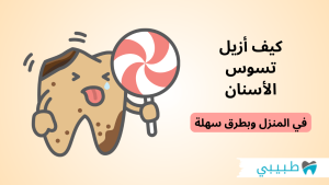 كيف أزيل تسوس الأسنان فى المنزل