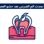 لماذا يحدث الم الضرس بعد حشو العصب؟ وكم يستمر الألم؟