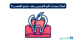 لماذا يحدث الم الضرس بعد حشو العصب؟ وكم يستمر الألم؟