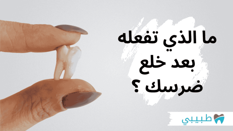 ما الذي يجب فعله بعد خلع الضرس