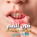 مرهم-لعلاج-قرح-الفم