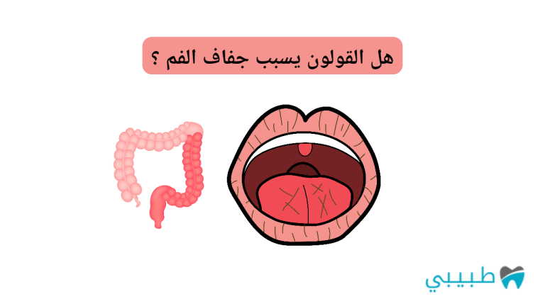 هل القولون يسبب جفاف الفم؟