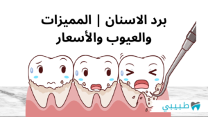 برد الأسنان