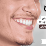طريقة تبييض الاسنان في المنزل بأفضل الطرق ونصائح هامة جدًا