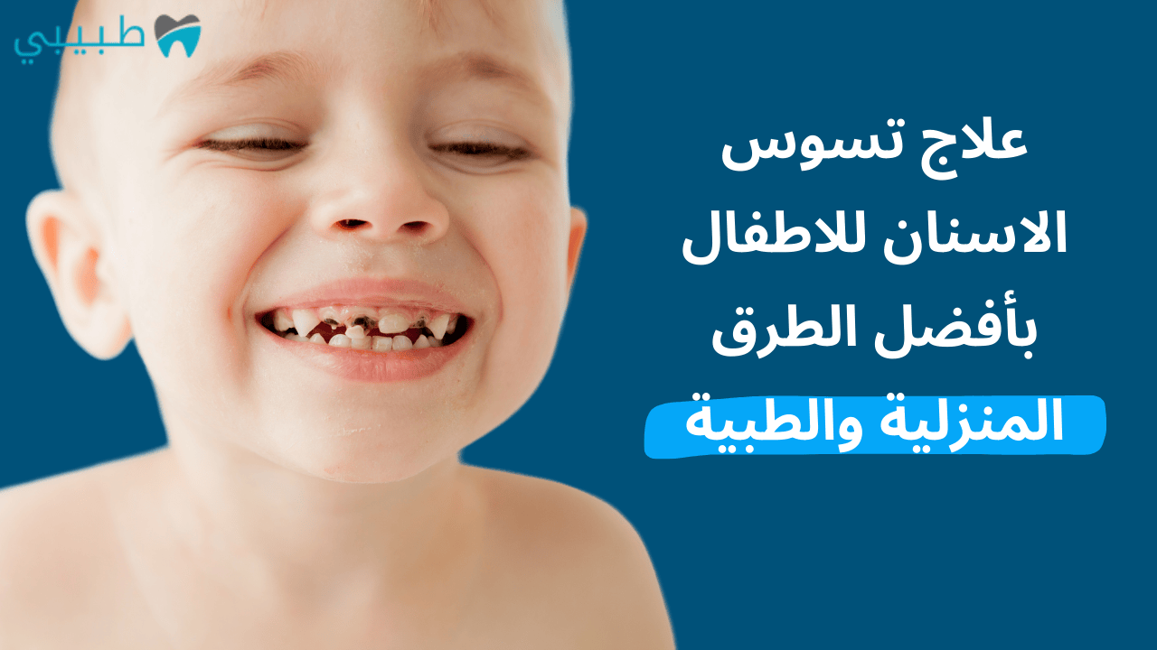 علاج تسوس الاسنان للاطفال بأفضل الطرق المنزلية والطبية