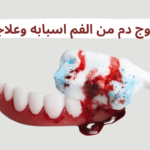 أسباب خروج الدم من الفم