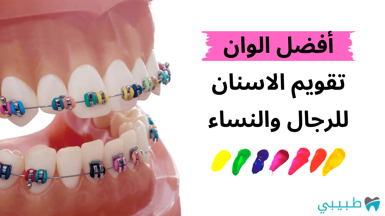 أفضل الوان تقويم الاسنان للرجال والنساء