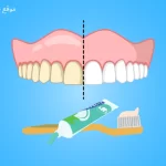 Best teeth whitening Toothpaste 2026