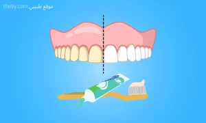 Best teeth whitening Toothpaste 2026