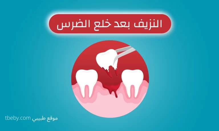 When Does Bleeding Stop After Tooth Extraction?