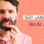 انواع التهاب اللثة